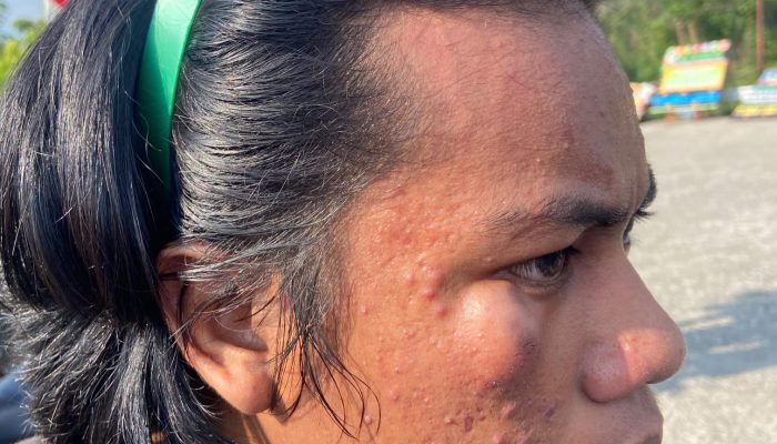 PMII Mamuju Ultimatum Polda Sulbar, Usut Dugaan Pemukulan Kader Saat Demo